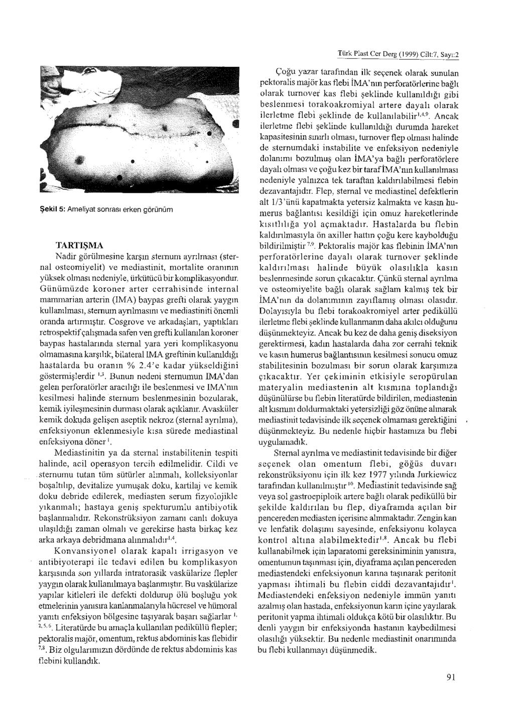 Türk Plast Cer Derg (1999) Cilt: 7, Sayı:2 Şekil 5: Ameliyat sonrası erken görünüm TARTIŞMA Nadir görülmesine karşın sternum ayrılması (sternal osteomiyelit) ve mediastinit, mortalite oranının yüksek