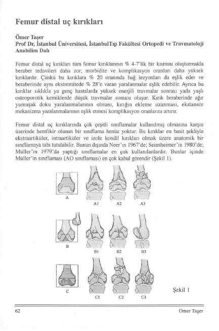 Femur distal uç kırıkları Ömer Taşer Prof Dr, İstanbul Üniversitesi, İstaubulTıp FakÜıtesi Ortopedi ve Travmatoloji Anabilim Dalı Femur distal uç kırıkları tüm femur kırıklarının % 4-7'lik bir