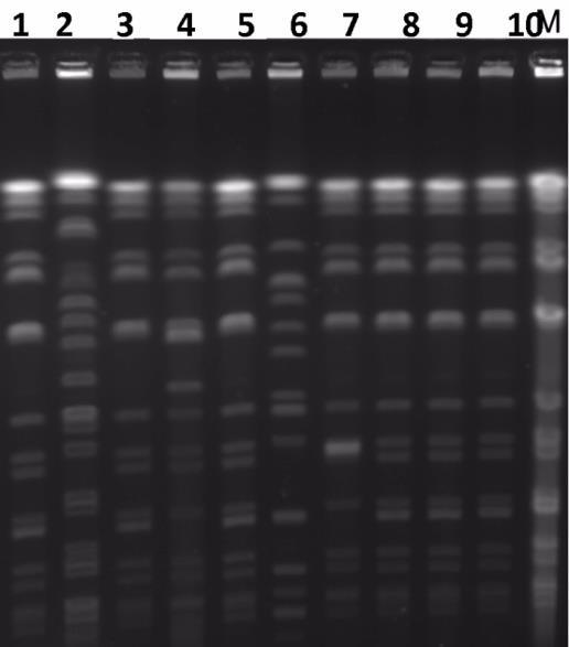 Salgın yönetimi Pulse field jel elektroforez (PFGE) İnfüzyon pompası, aynı suş ( dış merkezden gelen 2 hasta hariç) 8/14 rektal kolonizasyon, 3/8 enfekte OXA-48