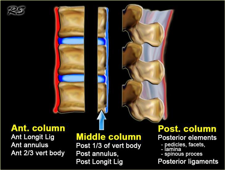 Denis in 3 kolon teoremi Ön kolon Anterior longitudinal ligaman 2/3 ön vertebral gövde ve disk Orta Kolon Posterior