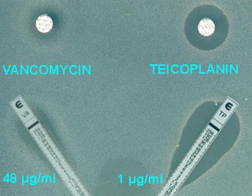 GLİKOPEPTİDLER Vankomisin MRSA,MRSE Yan etki: Filebit, Ototoksik, Nefrotoksik, Kırmızı adam sendromu Teikoplanin Bakteriostatik Etki gücü daha fazla Daptomisin