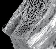 Bariyer membranın lokal kemiğe sabitlenmesinde, partiküler kemik rejenerasyon materyalinin uygulanmasının yanısıra, bariyer membranda augmentasyon tarafının kapsamı belirgin şeklinde