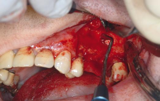 Klinik Olgular Oral cerrahi & Çene Yüz