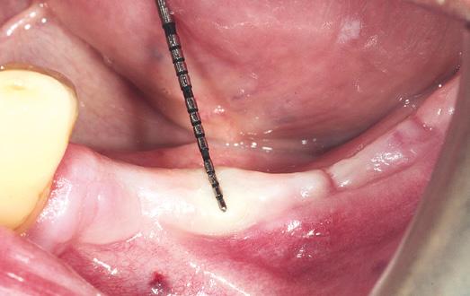 Klinik Olgular Oral cerrahi & Çene Yüz