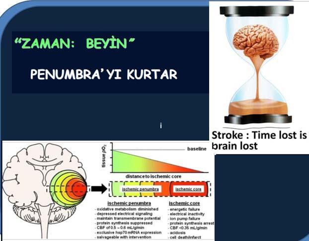 i AMACI Beyin kan akımını