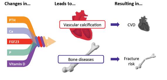 CKD MBD ve Sonuçları KDIGO Uptodate