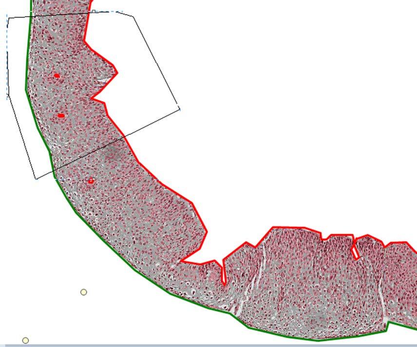 sayısal görüntü Sitoplazma Alanı (OSA) 320 adet büyük epitel bölgesi (BEP)