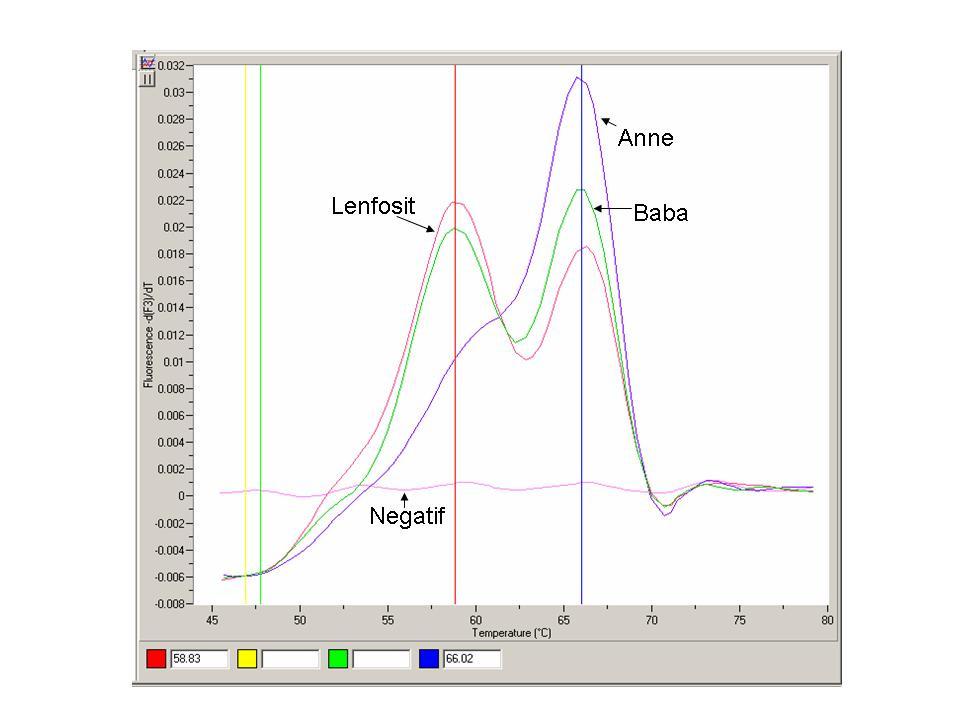 Şekil 17. Olgu 2 için F prob seti kullanılarak CD39 için yapılan LC erime eğrisi analizi.