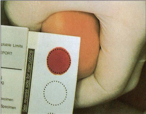 Topuk kanı nasıl alınır? Topuk kanı örnekleri 4 lü daire içeren standart kan örneği kağıdına alınmalıdır.