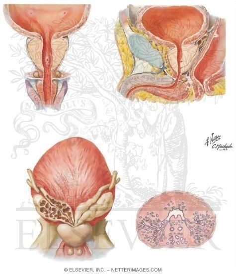 Prostat Anatomisi Önden Puboprostatik bağlar Altyüzden ürogenital diyaframla desteklenir