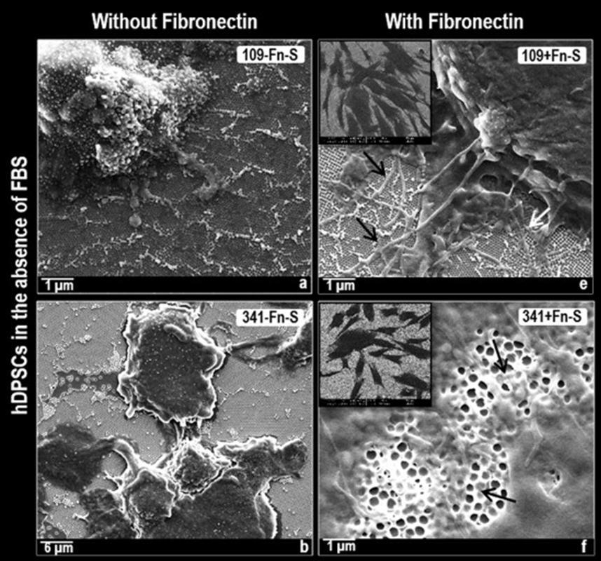 Impact of selective fibronectin