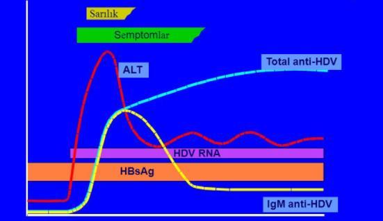 HBV-HDV Süperinfeksiyonu Kanda devamlı HBsAg (+) HDV nin alınmasını takiben antihdv IgM (+) Titre önce yükselir sonra düşer. AntiHDV titresi yükselmeye başlar.