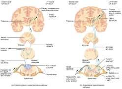 spinothalamicus lateralis ve anterior): Tr.spinothalamicus lateralis Taşıdığı duyular: Ağrı, ısı I.