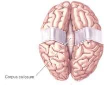 CORPUS CALLOSUM 2.