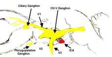 KRANIAL SINIRLER Trigeminal sinir KRANIAL SINIRLER Trigeminal sinir KRANIAL SINIRLER VI. N.