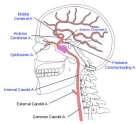 Eğer enjeksiyon yapılan hemisfer konuşmadaki dominant hemisferse, hasta anestezinin etkisi geçene kadar