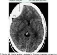 CEREBRI ANTERIOR  