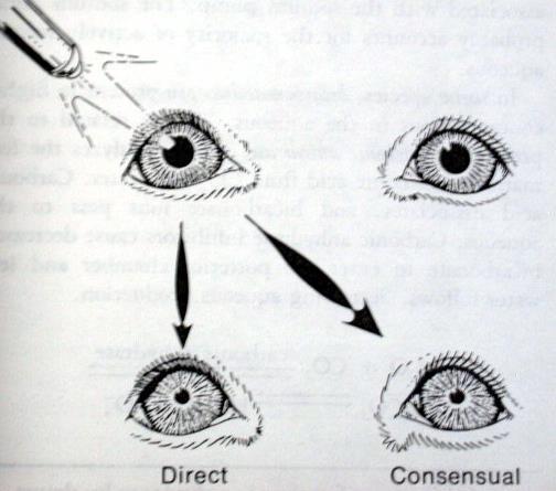 Pupillar ışık refleksi: Bir gözün fotoreseptörlerinin ışıkla uyarılması sonucu
