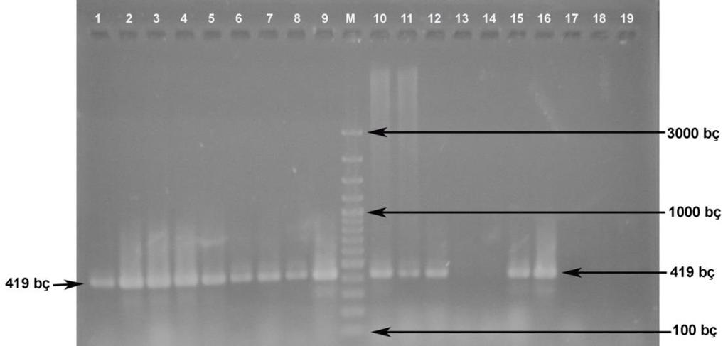 Jelatinaz üretim özelliğinin genetik determinantlarının araştırıldığı PZR denemeleri sonucu 54 Enterococcus suşundan 33 ünün (% 61.11) 
