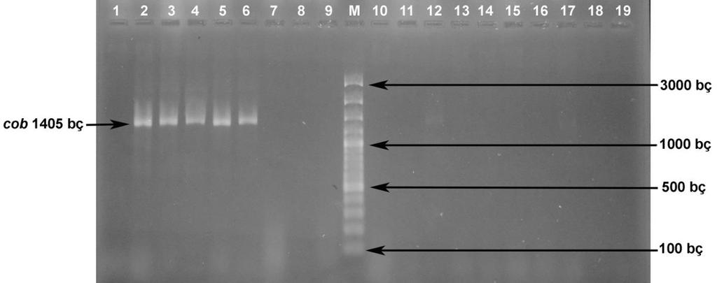 Şekil 4.8. Enterococcus suşlarında cob geninin PZR amplifikasyonu 1. E. faecalis RS27.3 : - 2. E. faecalis RS27.4 : 1405 bç 3. E. faecalis RS27.5 : 1405 bç 4. E. faecalis RS27.6 : 1405 bç 5. E. faecalis RS29.