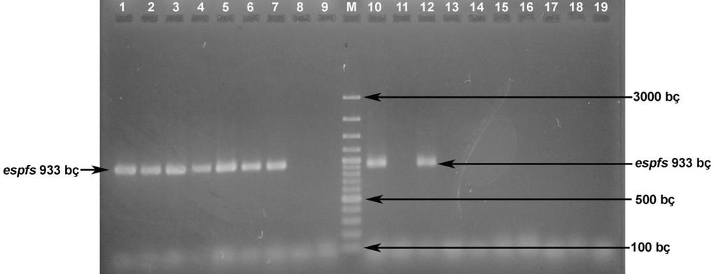 Şekil 4.9. Enterococcus suşlarında espfs geninin PZR amplifikasyonu 1. E. faecalis RS27.3 : 933 bç 2. E. faecalis RS27.4 : 933 bç 3. E. faecalis RS27.5 : 933 bç 4. E. faecalis RS27.6 : 933 bç 5. E. faecalis RS29.