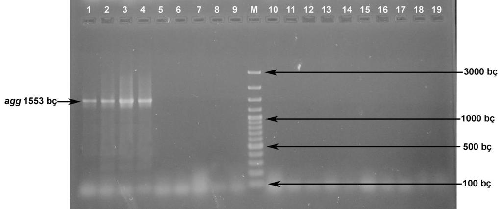 geninin varlığının bildirildiği çalışmalar da bulunmaktadır (Semedo vd., 2003; Yüksel vd., 2012). Şekil 4.10. Enterococcus suşlarında agg geninin PZR amplifikasyonu 1. E. faecalis RS27.3 : 1553 bç 2.