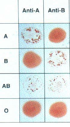 Kan grubu tayini Eritros it tipi Anti-A serumlar Anti-B A + - B - + AB + + O - - Kan tiplemesi bireylerin kırmızı hücrelerini