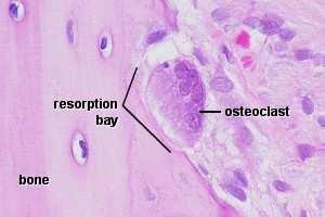 2.2.3.4. Osteoklastlar Howship lakünası adı verilen boşluklarda yerleşmiş olan bu hücreler kemikte yıkımı veya kemik rezorbsiyonunu gerçekleştirmektedir (Resim 1).