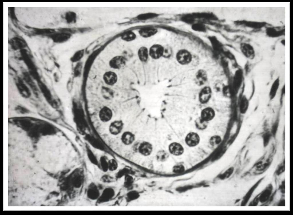Hücre yüzeyinin uğradığı morfolojik değişimler