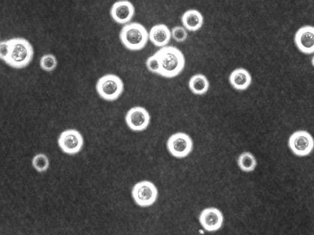 Cryptococcus