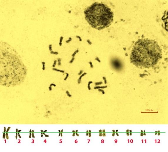 Table 2. Chromosome characteristics in Q. libani (Population 2: Piranshahr) Chromosome Short Arm Length Centromer Index Number (µm) Long Arm (µm) 1 49.01 1.00± 0.17 1.04± 0.39 2 46.19 0.85± 0.32 0.