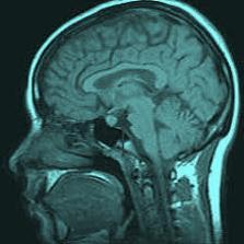 HIPOTALAMUS Küçük bir beyin yapısı olmasına rağmen, hayatta kalmamız için gerekli olan çok sayıdaki çekirdek ve liflerden oluşur. Neden mi?