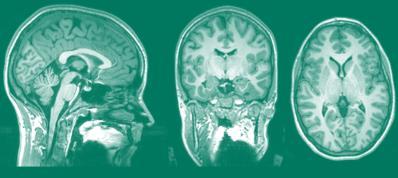 Serebral korteks ve orta beyin arasında, beyin sapının hemen üzerinde bulunan gri maddeden oluşan küçük bir yapıdır.