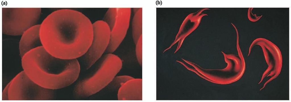 Orak hücre anemisi Orak-hücre anemili hastalardan elde edilen mutant hemoglobin molekülleri ile yapılan çalışmalar, genlerin enzimler dışındaki proteinleri de kodladığının doğrudan ilk kanıtları