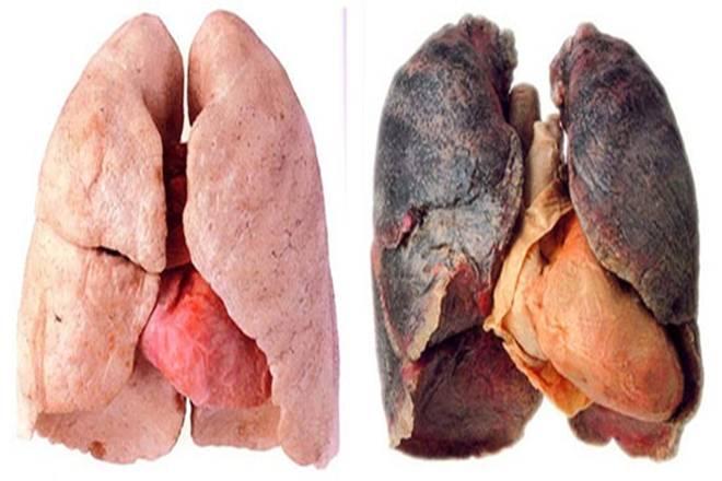 SİGARA Akciğer fonksiyonlarını bozar. Akciğer gelişimini bozar. Öksürük, balgam, hırıltılı solunum, nefes darlığı yapar.