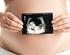 Spontan ve IVF ikiz gebeliklerin obstetrik ve perinatal sonuçlarının karşılaştırılması
