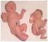 )üşük Doğum Ağırlıklı Bebeklerin Perinatal Sonuçlarının Değerlendirilmesi