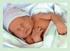 Serebral Palsi. Neonatal Prematürite(36.haftadan önce gerçekleşen doğum), Düşük doğum ağırlığı(<2500 gr), Büyüme geriliği, DERMAN.