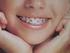 - Ortodontik tedavi (tel tedavisi) hangi yaşlarda yapılır?(dişler her yaşta düzelir mi?)