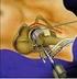 Kalça eklemi klasik bir top ve yuva tipi eklemdir. Kalça eklemi anatomisi ve biyomekaniği. Anatomy and biomechanics of the hip joint.