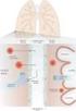 How should Approach to Pleural Effusion?