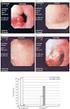 Helicobacter Pylori ve Eradikasyon