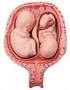 Makrozomik Gebeliklerin Doğum Şekilleri ve Sonuçları. Kadın Hastalıkları ve Doğum Kliniği, Şarkikaraağaç Devlet Hastanesi, Isparta