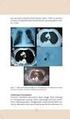 Pozitron emisyon tomografisi. Dr. N. Özlem KÜÇÜK Ankara Üniversitesi Tıp Fakültesi Nükleer Tıp ABD