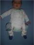 Dört Hafta- Altı Ay Arası Bebeklerde Gelişimsel Kalça Displazisi Taramasında Ultrasonografik Çalışma Sonuçları