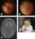 Retrospektive analysis of 48 cases with thoracic trauma