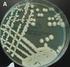 DISTRIBUTION OF CANDIDA SPECIES IN VAGINAL SPECIMENS AND EVALUATION OF CHROMAGAR CANDIDA MEDIUM. Berna GÜLTEKİN**, Vesile YAZICI**, Neriman AYDIN**