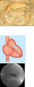 Successful Percutaneous Coronary Intervention in Coronary Artery Originating Anomaly