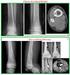 Çocukluk çağı Kemik Tümörlerinde Radyoloji