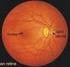 Miyopide Makula ve Retina Sinir Lifi Tabakası Kalınlığının Optik Koherens Tomografi ile Değerlendirilmesi